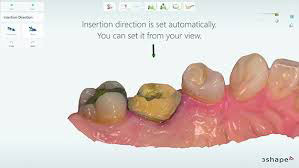 3shape Trios Software 3shape Trios Software